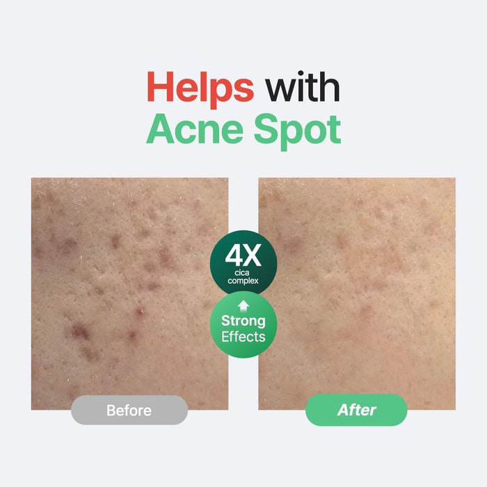 PURITO SEOUL Wonder Releaf Centella Serum Unscented 60ml | Barrier Repair Serum